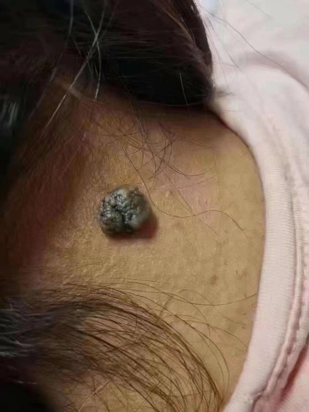 我的斑
怎么突然长出来了?🤔
