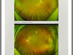 -武汉大学附属爱尔眼科医院(湖北总院)