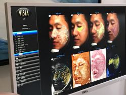 -苑苑vbeauty科技美容SPA