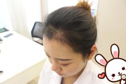 -大麦微针植发丨全国连锁