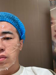 体验前-深圳米兰柏羽医疗美容医院