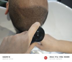 -雍禾植发全国连锁