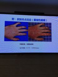 -成都军建医院·疤痕诊疗中心