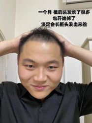 -雍禾植发全国连锁