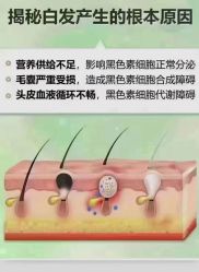 -顶尚堂白发脱发养发
