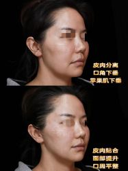-Yestar重庆艺星医疗美容医院
