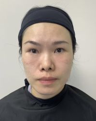 -广州健丽·去眼袋医疗美容机构