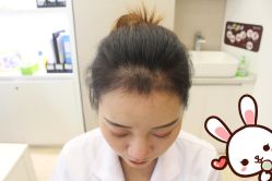 -大麦微针植发丨全国连锁