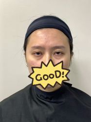 -天津健丽·去眼袋医疗美容机构
