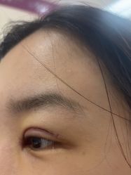 -广州美莱医疗美容医院