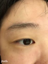 -伊丽莎白医疗美容