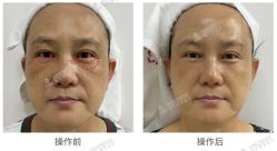 -安吉拉青春化管理中心