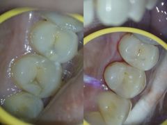 -同步齿科·数字化正畸种植口腔中心(珠海店)