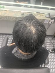 -唐风采假发补发定制