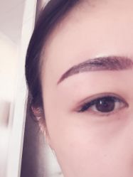 iphone_upload_pic-元熙兰积皮肤管理