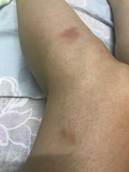-再清椿美容