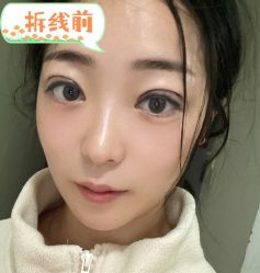 -素美医疗美容·西南眼鼻整形·修复基地