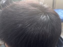 -极客侠男士假发定制补发