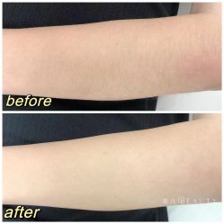 -植蔻妍倍儿专业脱毛·皮肤管理