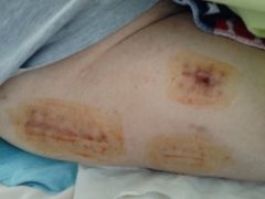 -上海爱以德护理院·康复(宝山院)