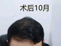 -雍禾植发全国连锁