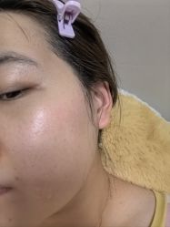 -Yestar艺星整形
