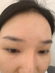 -长沙雅美医疗美容医院