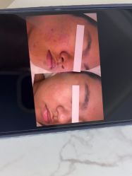 -白博士祛痘·皮肤管理中心