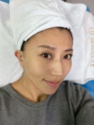 点击看大图 体验前-叶美人医疗美容