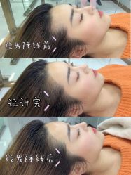 -OnFaer.纹眉半永久无创洗眉