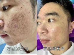 -蕾特恩专业祛痘·皮肤管理