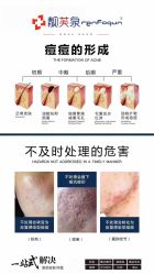 -靓芙泉祛痘.科技美肤连锁