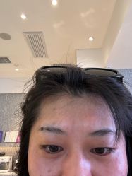-爱小熊轻医美