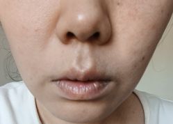 -北京润美玉之光医疗美容