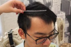 点击看大图 -大麦微针植发丨全国连锁