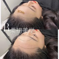 -RC半永久纹眉纹发际线