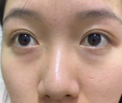 -天津健丽·去眼袋医疗美容机构