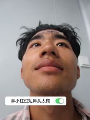 -素美医疗美容·西南眼鼻整形·修复基地