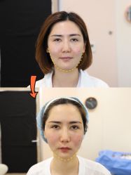 -上海时光整形外科医院