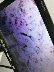 点击看大图 -蕾特恩专业祛痘·皮肤管理