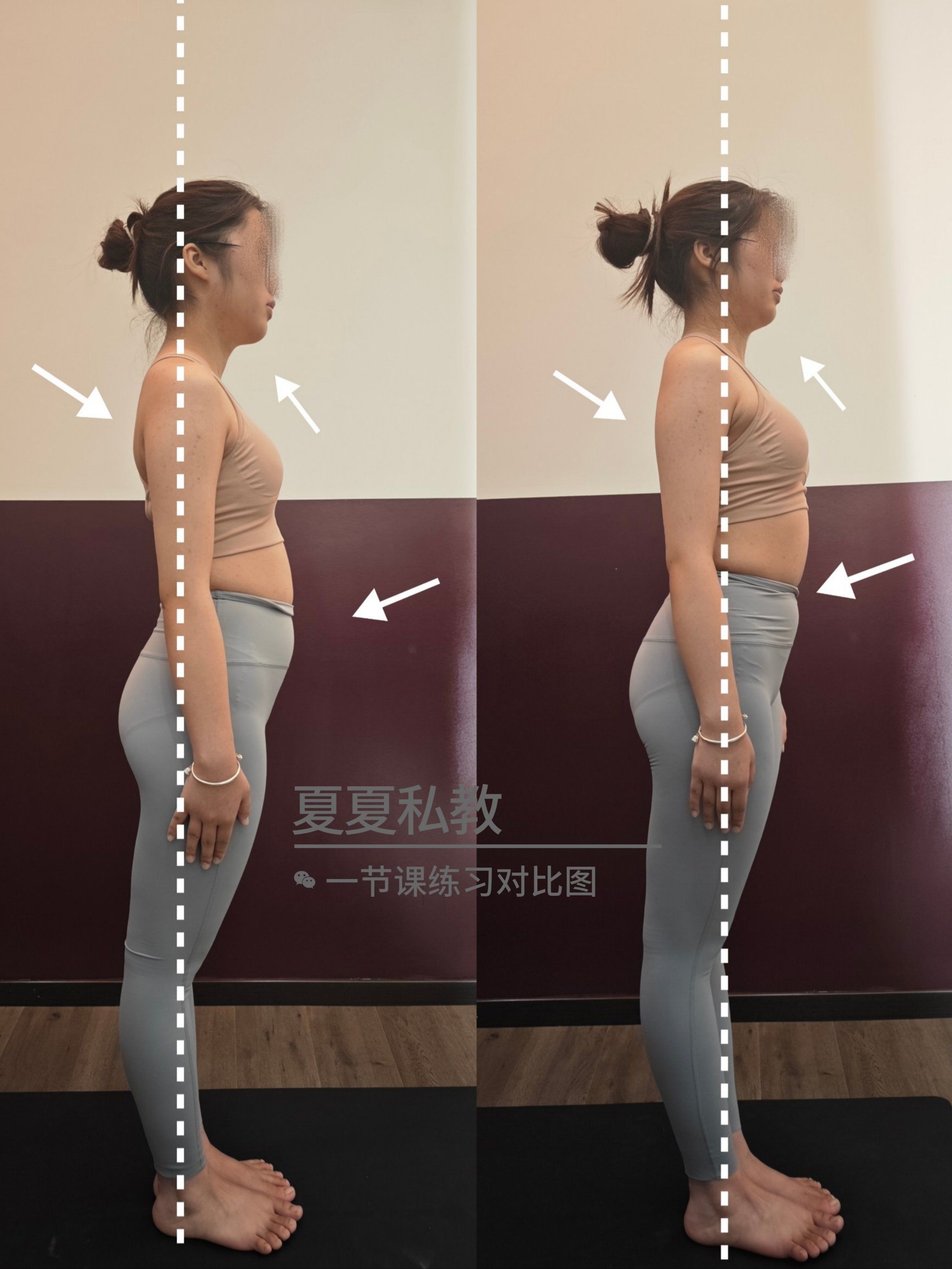 n​头前引,骨盆前倾,含胸驼背,肩内扣
让你一节课看出效果[ok]