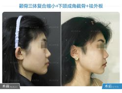 -圣嘉新医疗美容医院