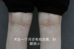 -圣嘉新医疗美容医院