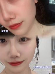 -颜蕾医美黄金微针水光美肤玻尿酸抗衰中心