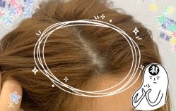 -大麦微针植发全国连锁