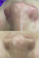 -蕾特恩专业祛痘·皮肤管理