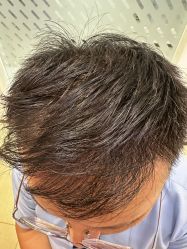 -雍禾植发全国连锁