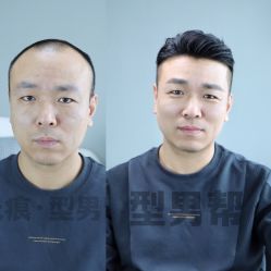 -型男帮男士假发补发·佩戴式发型