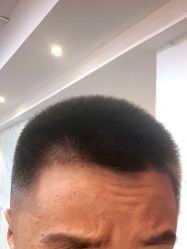 -热发型