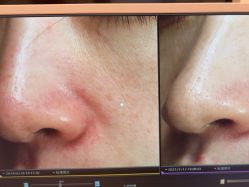 -苑苑vbeauty科技美容SPA